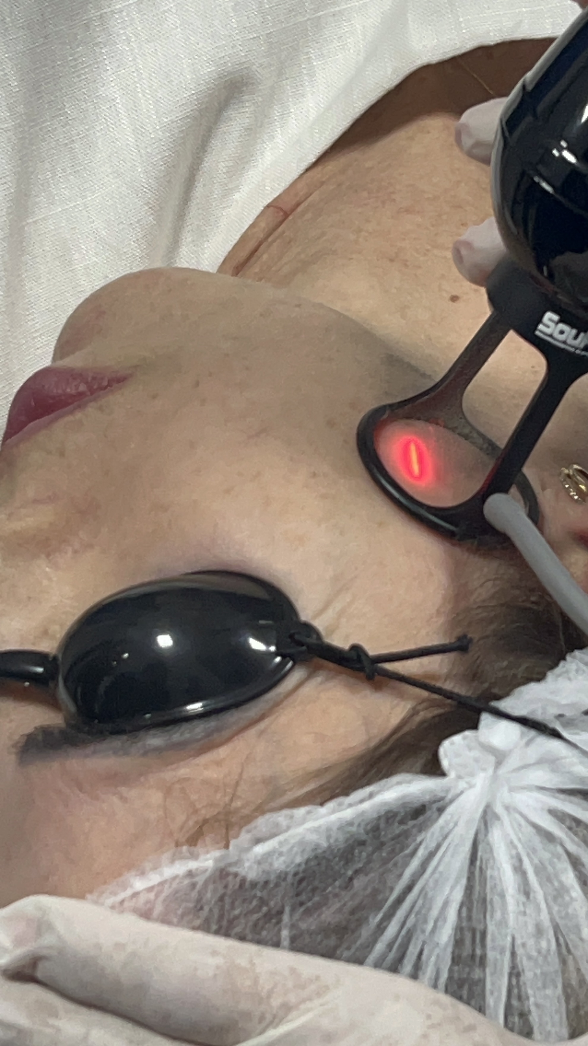 Laser CO₂ Expert
